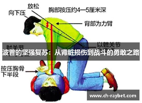 波普的坚强复苏：从肾脏损伤到战斗的勇敢之路
